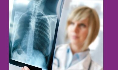 Qu'est-ce que la sclérose latérale amyotrophique, aussi appelée maladie de Charcot ?