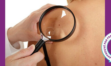 prevenir-cancer-de-la-peau Prévenir le cancer de la peau